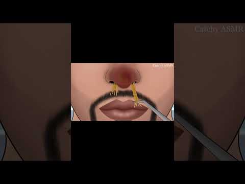 #asmranimation #nasalsecretion #asmrsound #nasalseptum #asmrvideo #skincare #asmrtapping  #animation