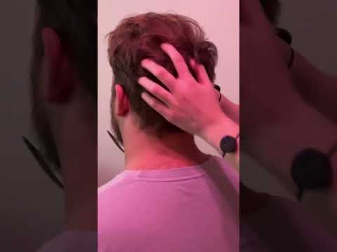 Fast & Aggressive ASMR Head Scratch #relax #oddlysatisfying #asmrforsleep #asmrtingles
