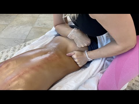 Moving NERVES THROUGH the SKIN!