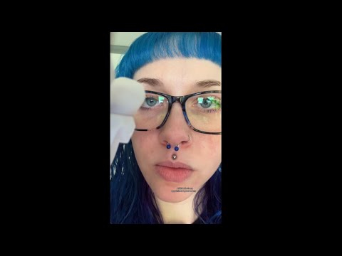 ASMR lobotomy appointment gone wrong 😰