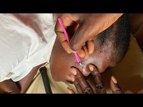 asmr ear cleaning real person_ bubble gum
