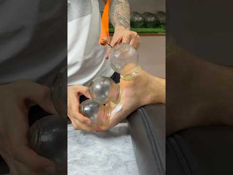 ❤️😍#cupping #shorts #viral #youtubeshorts #explore #asmr #asmrsounds