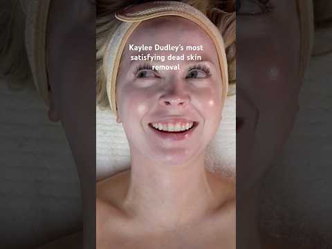 Kaylee Dudley’s most satisfying dead skin removal