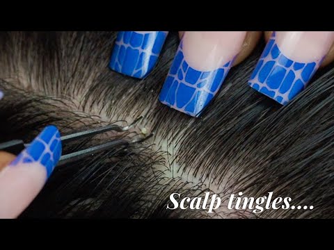 ASMR Super Attentive Nitpicking Whiteheads ~ whispers for sleep 💭