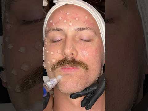 ASMR Skintracing Facial on BeetleJuice