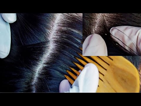 ASMR | Sleep Recovery 2HRS Hair Treatment & Inspection  🔍