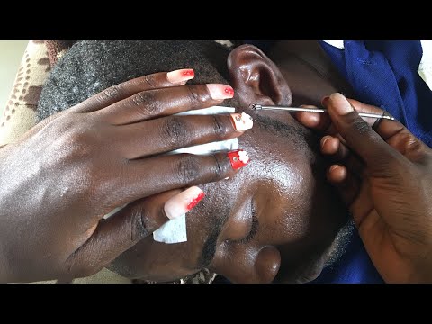 Super Attentive  Ear Nitpicking #asmr #blackheads #nitpicking