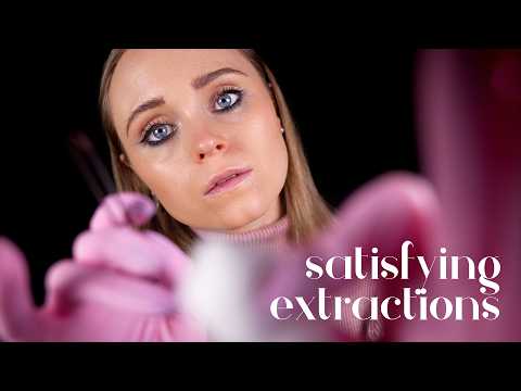 ASMR | Tackling your CYSTIC ACNE (satisfying acne extractions and picking)