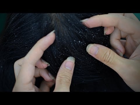 ASMR Scalp Check, Scalp Massage, Scalp Treatment With Oil For Deep Sleep