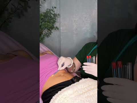 ASMR Stomach Sample Collecting 🩵 #asmr #asmrsounds #asmrtingles #asmrmedical