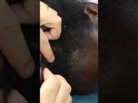 Nooo 🫣 her scalp actually cracked | full video on our channel #shorts #asmr #couple #youtubeshorts
