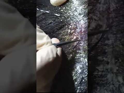 ASMR Tingly Scalp Check (Extreme Dandruff) #shorts