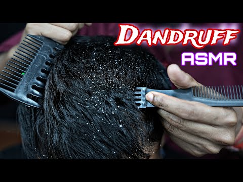 Dandruff Scratching ASMR | Heavy Oil Massage | Live Scratching ASMR Massage | Tapping & Scratching