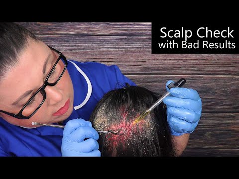 ASMR Scalp Check with Bad Results (Dandruff Removal, Scalp Treatment, Whispering) Medical Roleplay