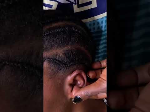 Asmr ear hole nitpicking #asmr #tingling #asmrvideos #nitpicking #skincare