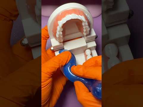 Making your mouth guard 🦷 #asmrdoctor #asmrvideo #shorts #insomnia #asmr #medical