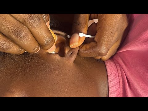 ASMR EAR CLEANING AND NITPICKING FOR THOSE WHO NEED INSTANT SLEEP, ALOT OF TINGLES
