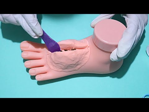 o que é isso no pé? (ASMR CIRURGIA)