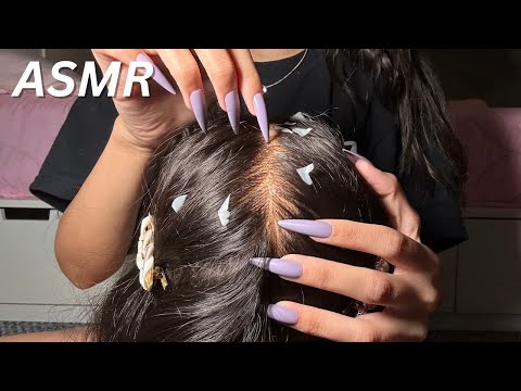 ASMR SCRATCHING THE DANDRUFF OFF YOUR SCALP *CRISPY SCALP*