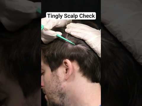 EXTREME TINGLES | Scalp Check #ASMR