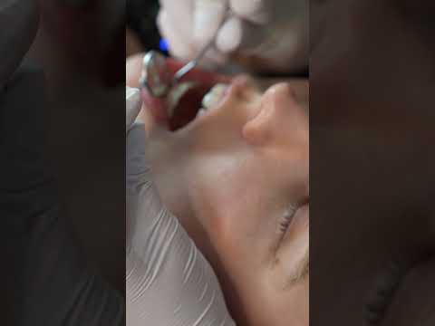 Daily Short(Sorry for Messed up Audio!) Dental Exam  #asmr  #asmrmedical #asmrdentist #asmrteeth