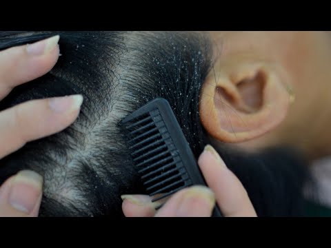ASMR Relaxing Scalp Check, Scalp Scratching, Combing For Sleep / No Talking