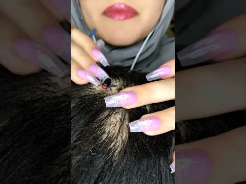 Bugs Lice Removal 🐜😱💆🏻‍♀️ #asmr #satisfying #asmrmassage #tingles #canada #shorts #relaxing