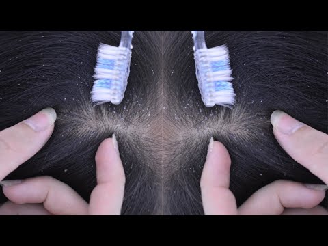 ASMR Scalp Scratching, Scalp Massage With Toothbrush, Hair Parting Relaxing For Deep Sleep
