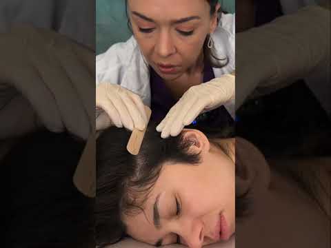 Asmr scalp tingles #asmr #asmrsounds #asmrvideo #relax #relaxing #satisfying #hair #sleep #tingles