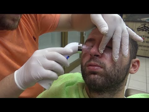 ASMR TURKISH BARBER = NECK CRACK=EAR BURN=SKIN CARE= BLACK MASK=head,arm,ear,face,back,sleep massage