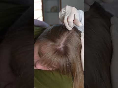 Asmr scalp 💆🏻‍♀️ #asmr #asmrsounds #asmrvideo #relax #relaxing #satisfying #hair #tingles #sleep