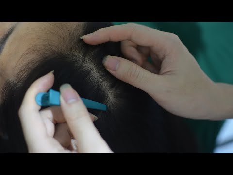 ASMR Hair Parting, Real Person Head Scratching Massage, Therapy Sounds For Headache Relief