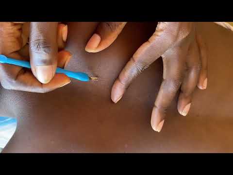 ASMR BACK SCRATCHING AND NITPICKING FOR SLEEP VERY RELAXING