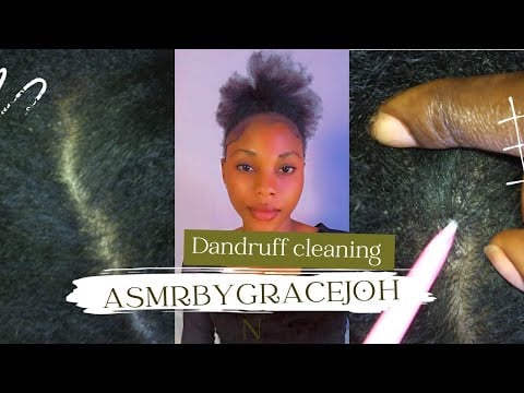ASMR SCALP SCRATCHING ON MY SISTERS AFRO HAIR- FOR THOSE WHO WANT TO SLEEP #sleep  #dandruff #asmr