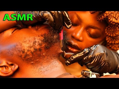 ASMR Intense Beard Scratching &Neck Massage (Ingrown Hair Removal + Nitpicking)4 Deep Sleep.with Gum