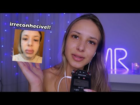 ASMR - PRECISAMOS CONVERSAR..! O que aconteceu com meu rosto? Estou proibida de usar maquiagem?!