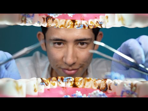 ASMR POV: Dentist Cleans Your ROTTEN Teeth (4K) 🦷