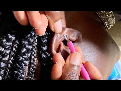 ASMR EAR CLEANING AND PICKING SO RELAXING WITH GUM CHEWING