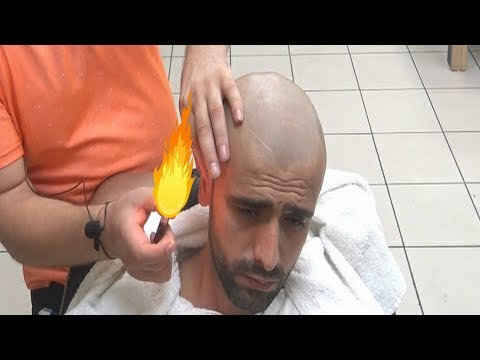 ASMR TURKISH BARBER💈NO TALKING💈 head razor shave💈EAR BURN💈cheek hairs wax💈HEAD,EAR MASSAGE=