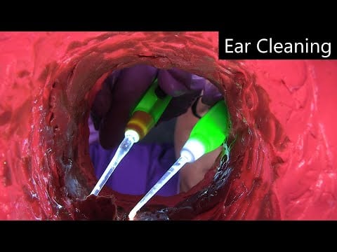 ASMR Ear Cleaning (Ear Exam, Otoscope, Ear Picking, Ear Scraping, Light Triggers) Medical Roleplay