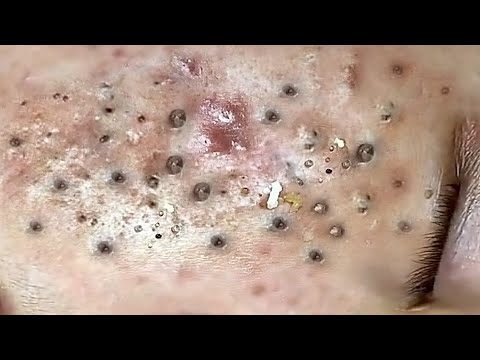 حلول طبيعية لبشرة صافية# 𝐒𝐤𝐢𝐧 𝐂𝐚𝐫𝐞 99553