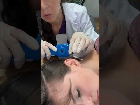 Asmr scalp tingles #asmr #asmrsounds #asmrvideo #relax #relaxing #satisfying #hair #sleep #tingles