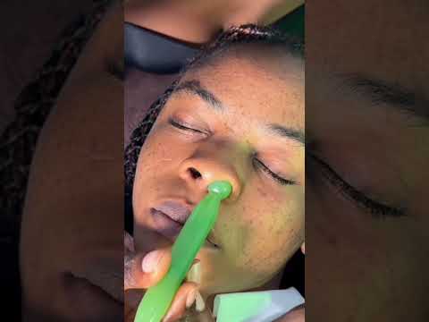 #asmrbygracejohn #satisfying #asmrvideos #earcleaning #relax ear cleaning