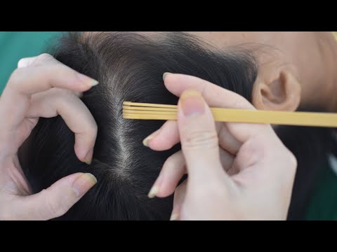 ASMR Scalp Check With Sticks, Scalp Scratching No Talking For Deep Sleep