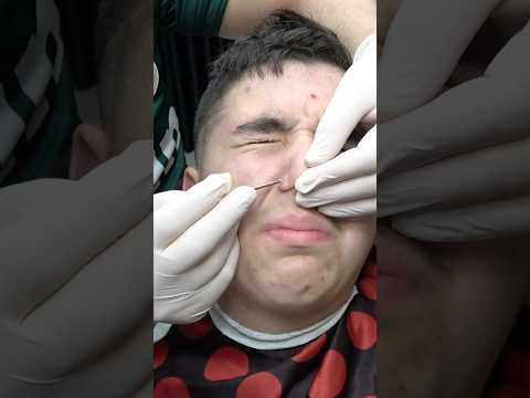 💈 Barber ASMR Skin Care , Enjoy Massage And Cracks #barbermassage #haircut #asmr #skincare #cracks
