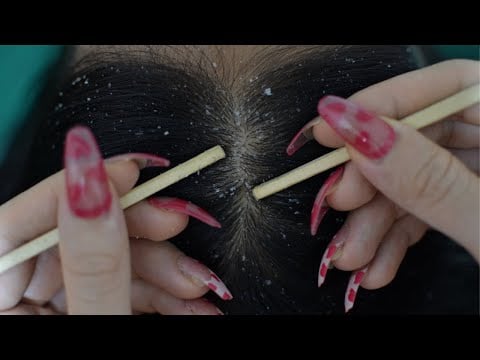 ASMR Relaxing Scalp Check With Chopsticks For Deep Sleep ( Scratching, Hair Parting, Combing )