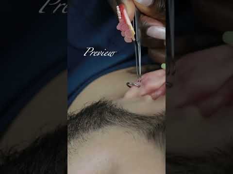 Perfectionist DEEP Cleaning|NITPICKING ears | FULL VIDEO ON OUR YOUTUBE CHANNEL #shortsvideo #shorts