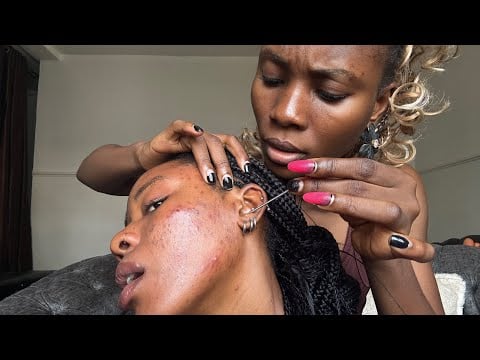 ASMR † Face Pimple pop, Bobby pin, Tooth-pick, Dental floss and Deep Ear Cleaning