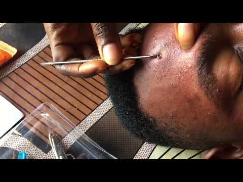 Asmr-  A real person Nitpicking for a good sleep. Touching and cleaning #asmr #satisfying