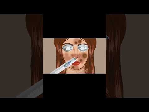 laser acne treatment animation|| Animation ASMR #skintreatment #creator #asmrsounds